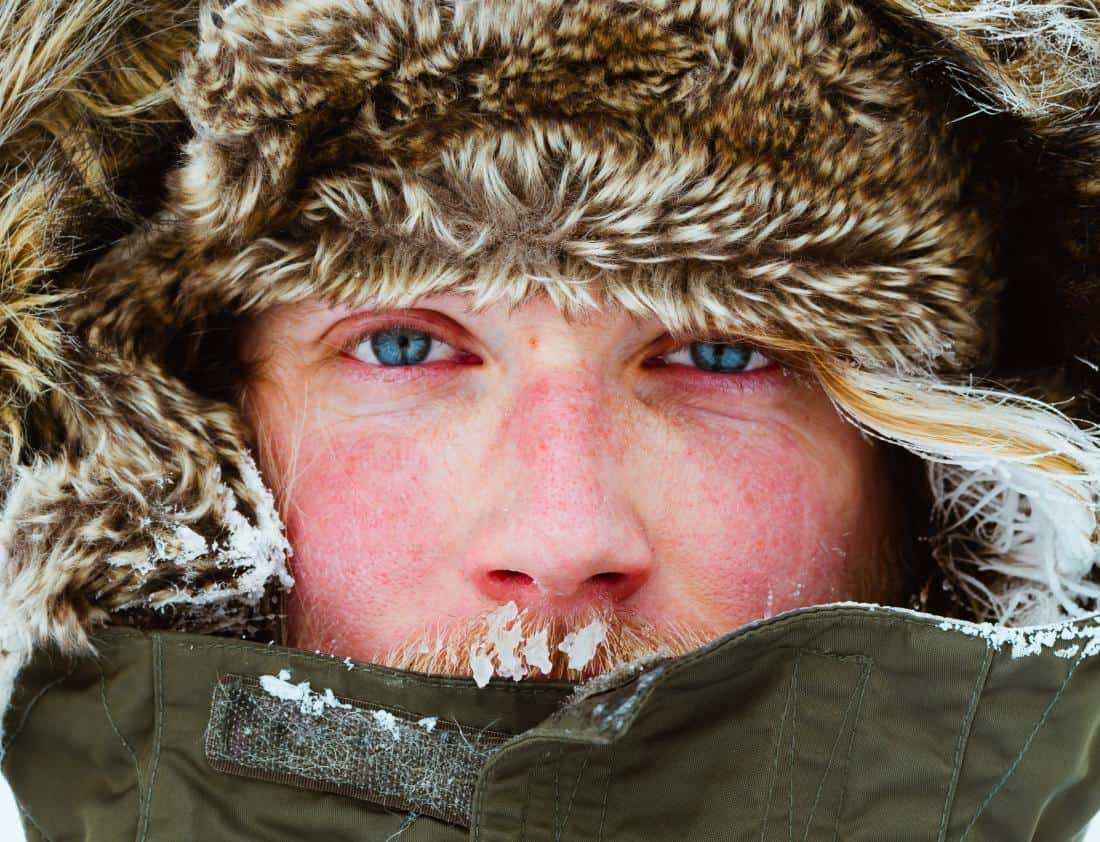 Wiki Fit - man-with-wind-burn